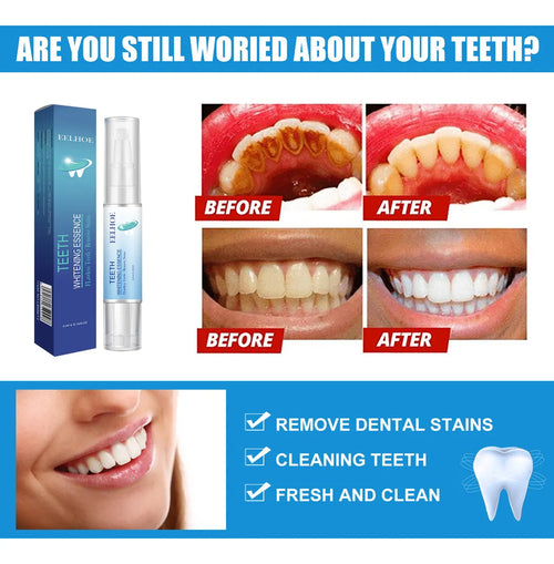 Blanqueador Dental PRO